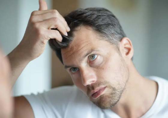 Perdre ses cheveux