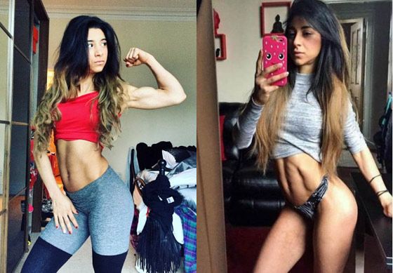 Fitness modèle anorexique